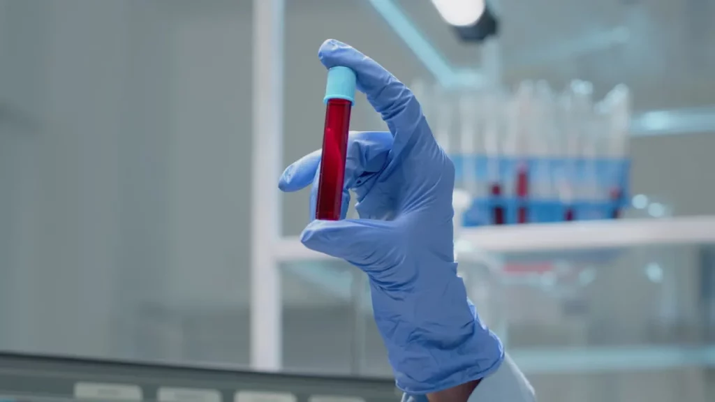 Blood test for review by licensed providers